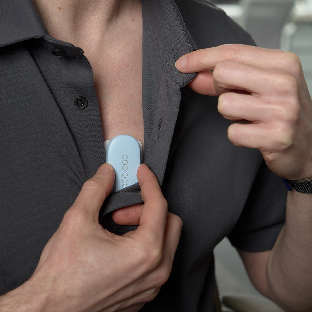 Stop Burnout Before It Starts